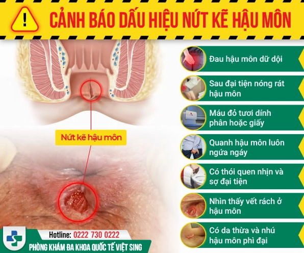 au-nhoi-hau-mon-nguyen-nhan-trieu-chung-va-cach-xu-ly-2026_811