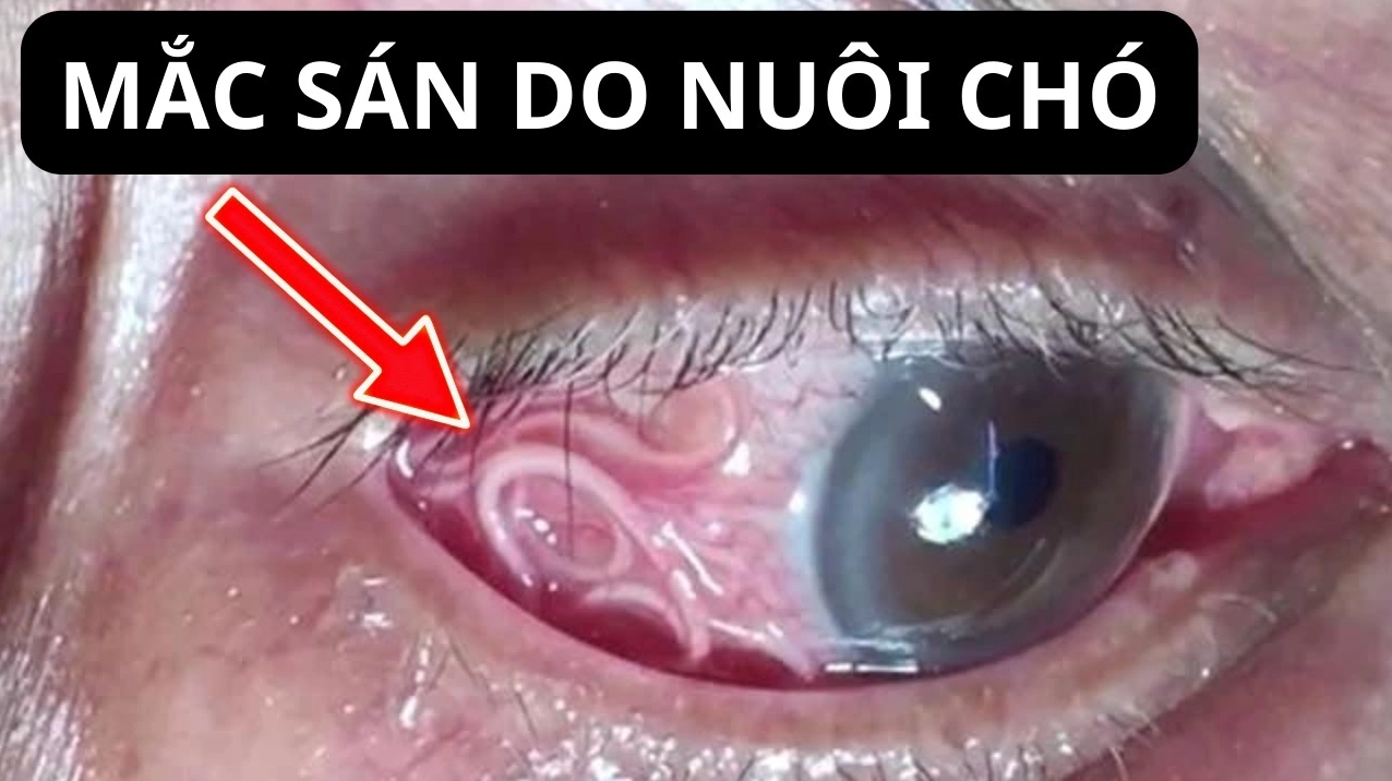 bác sĩ khám mắt