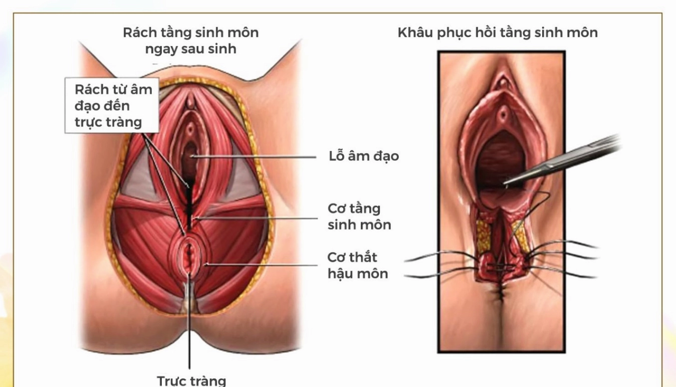 Bác sĩ khám phụ khoa