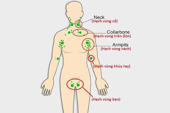 Bác sĩ thăm khám hạch cổ