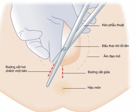 Biểu đồ cấu tạo sàn chậu