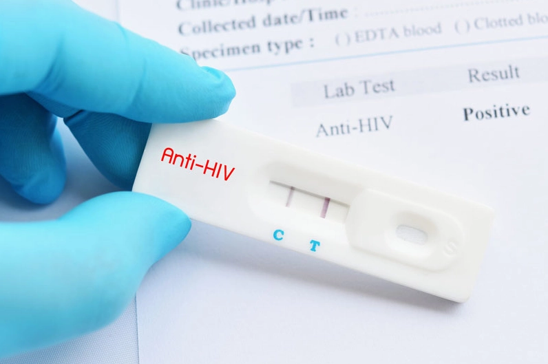 Các phương pháp xét nghiệm HIV