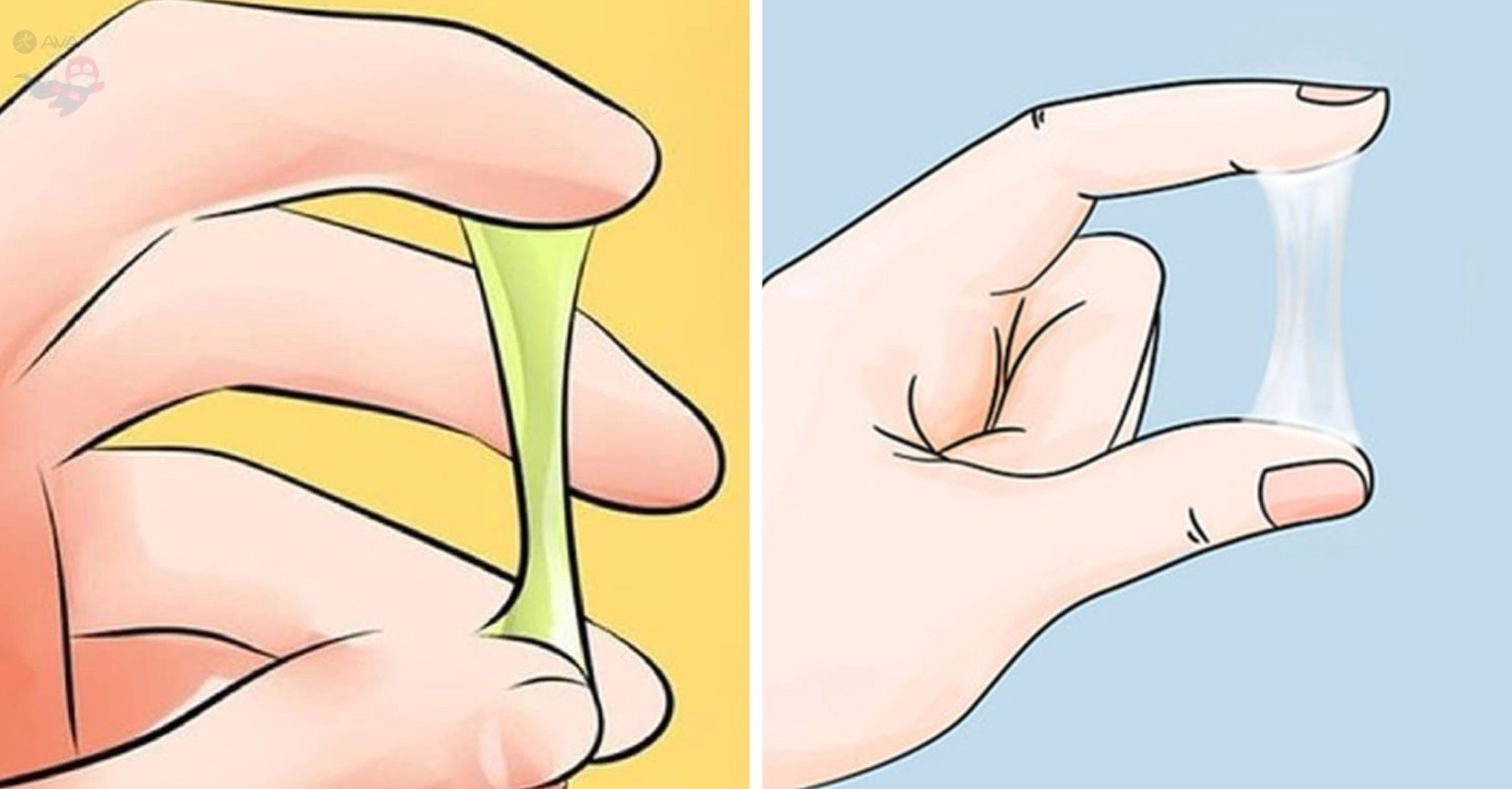 Cách nhận biết nước ối và huyết trắng