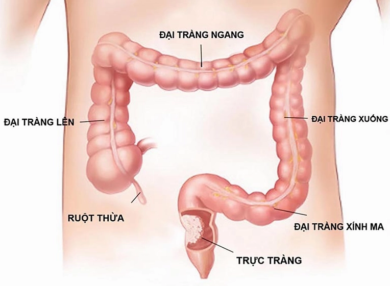 Cấu tạo các phần của đại tràng