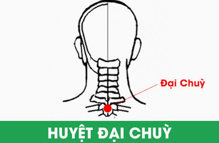 Châm cứu huyệt Đại Chùy