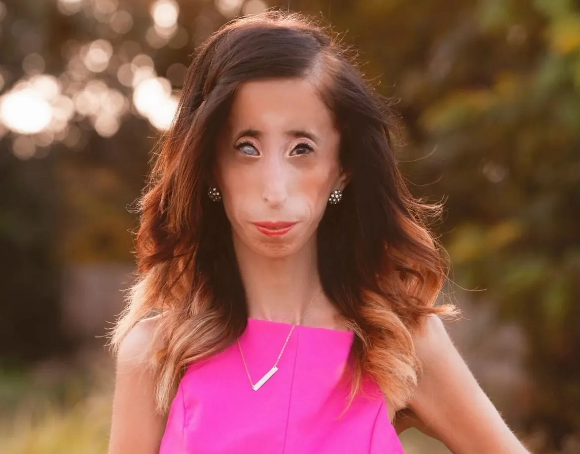 Chân dung Lizzie Velasquez với nụ cười tự tin