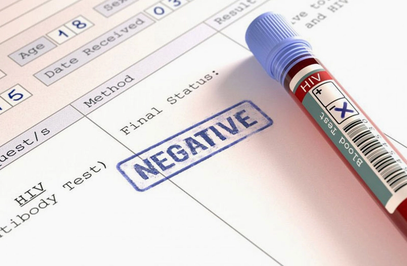 Chi phí xét nghiệm HIV là bao nhiêu?