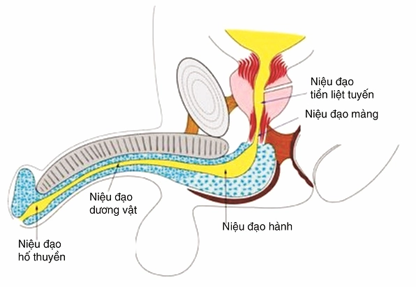 Hẹp niệu đạo