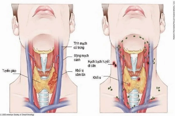 Hình ảnh minh họa lối sống lành mạnh