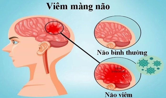 Hình ảnh minh họa người đang rửa tay để phòng bệnh
