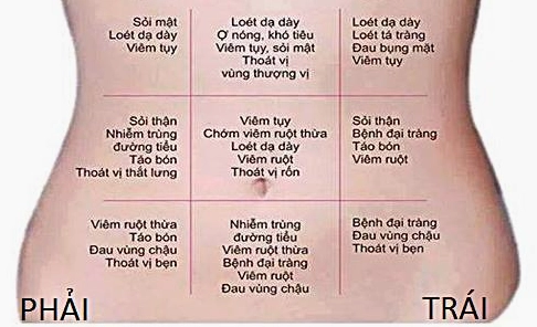 Hình ảnh minh họa ruột thừa bị viêm