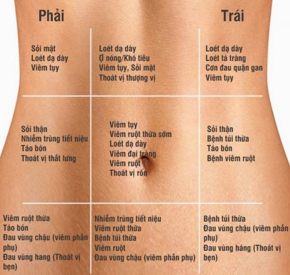 Hình ảnh minh họa vị trí đau bụng dưới bên phải