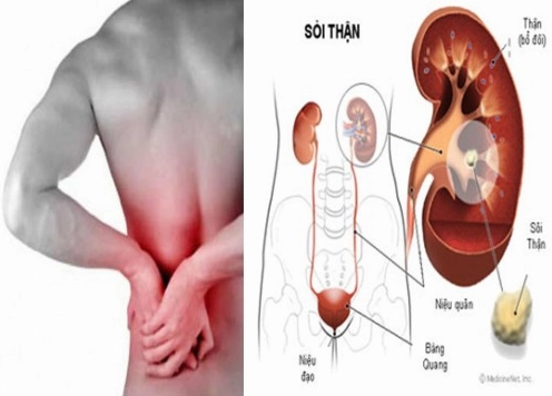 Hình ảnh minh họa vị trí thận