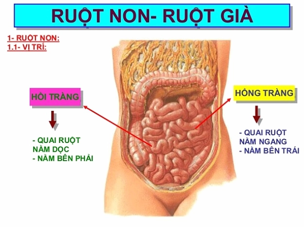 Hình ảnh minh họa vùng hồi tràng bị viêm