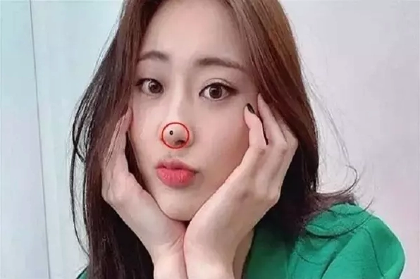 Hình ảnh người phụ nữ có nốt ruồi trên mũi