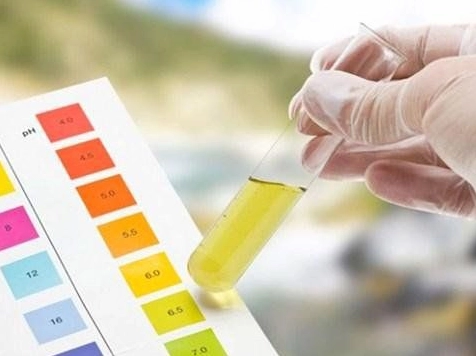 Hình ảnh que thử pH nước tiểu