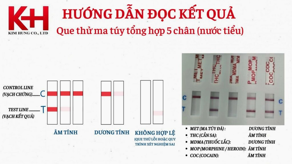 Kỹ thuật viên thực hiện test ma túy