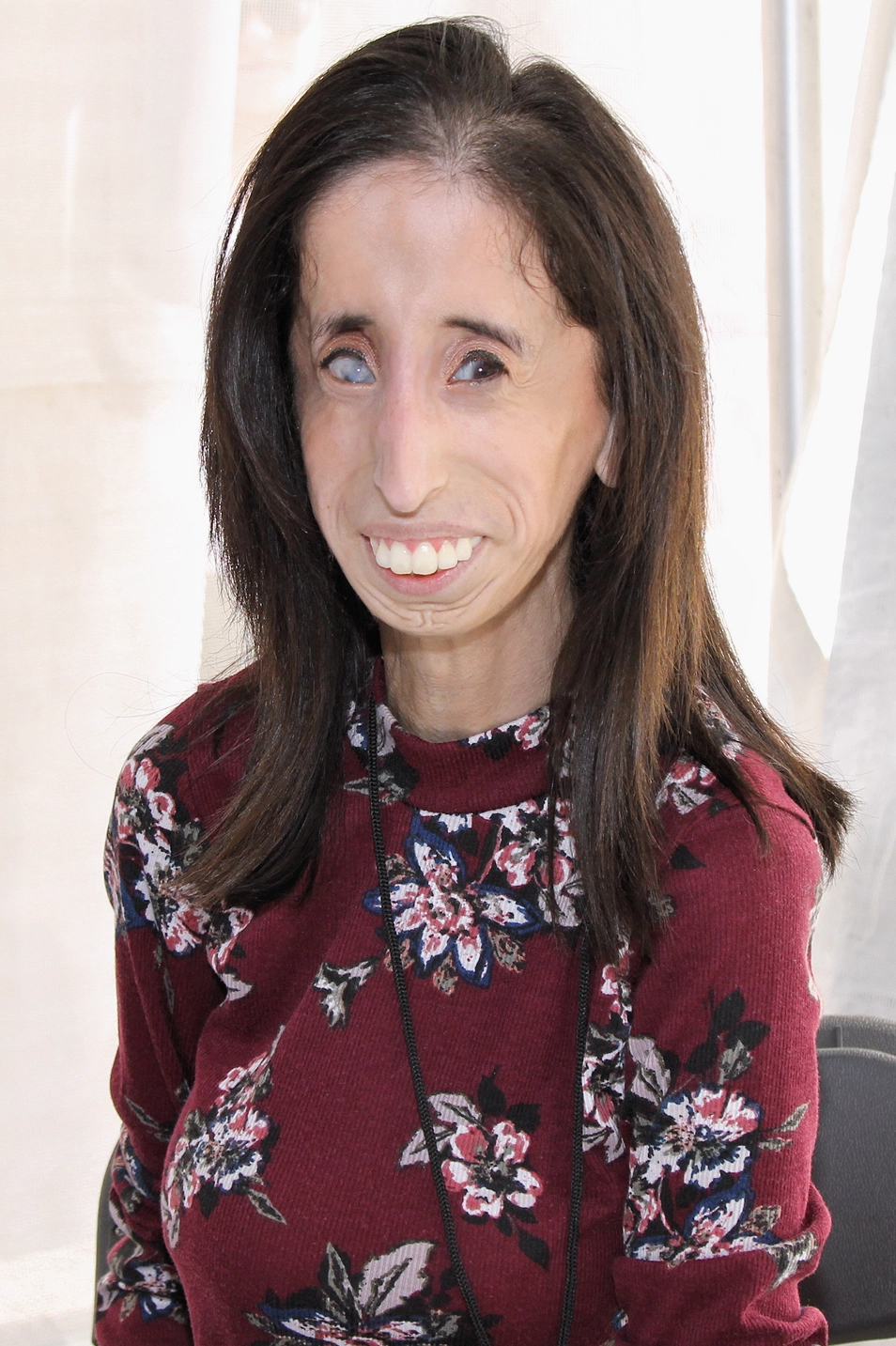 Lizzie Velasquez tươi cười trên sân khấu