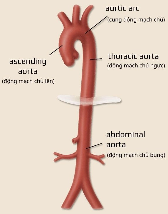 Lời khuyên về sức khỏe động mạch chủ