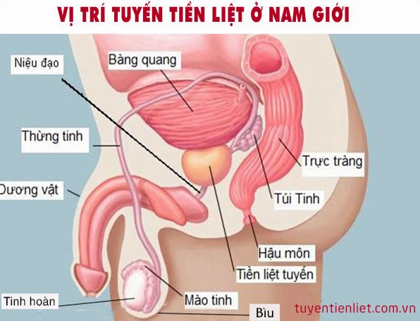 Minh họa cấu trúc tế bào ung thư tuyến tiền liệt