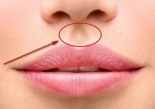 Minh họa huyệt Nhân Trung và tác dụng chữa bệnh