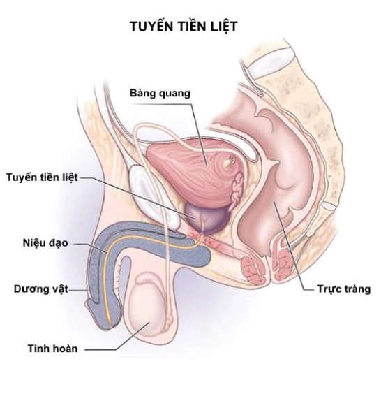Minh họa phì đại tuyến tiền liệt