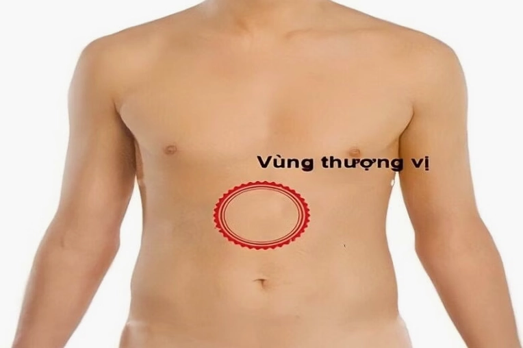 Minh họa vùng thượng vị và các cơ quan liên quan