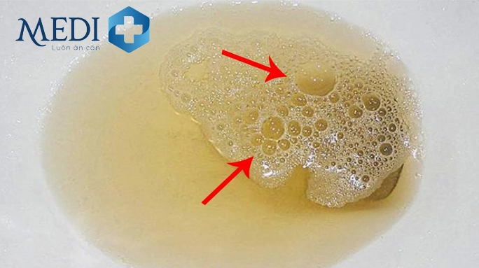 Người đàn ông đi tiểu trong nhà vệ sinh