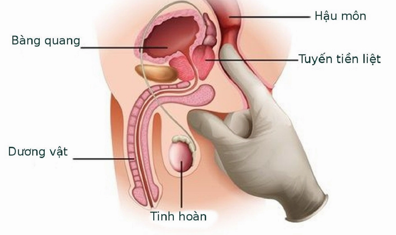 nieu-ao-la-gi-cau-tao-chuc-nang-va-cac-benh-ly-thuong-gap_502