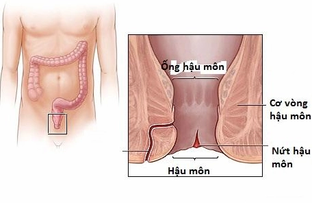 Nứt kẽ hậu môn gây đau nhói
