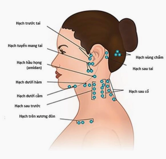 Sơ đồ vị trí hạch bạch huyết ở cổ