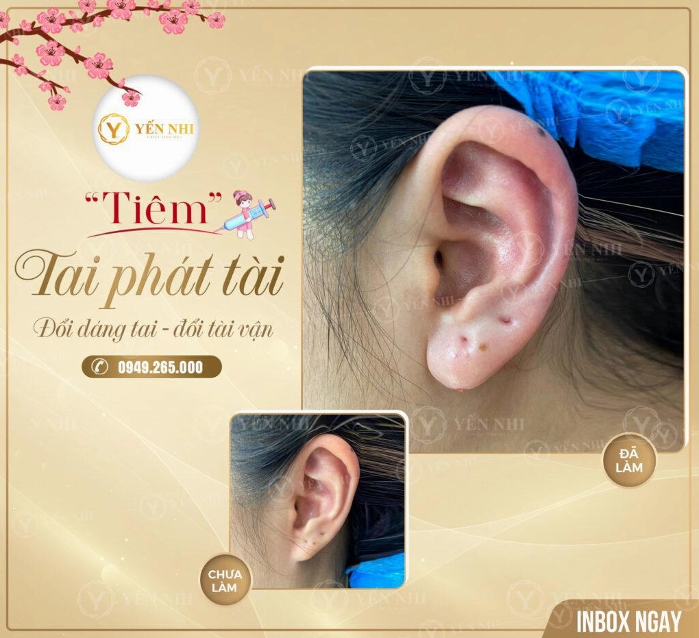 Tai và tài lộc trong nhân tướng học