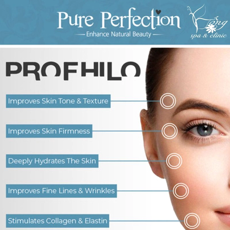 Tiêm Profhilo vào da mặt