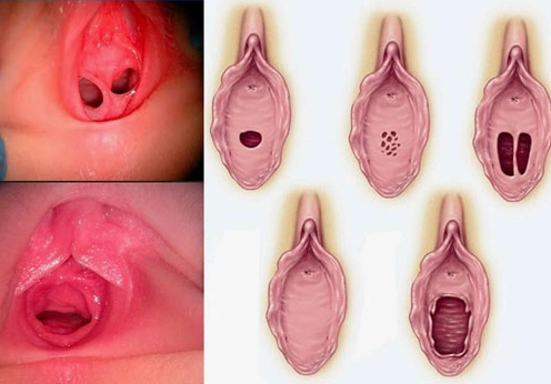 Tư vấn sức khỏe phụ khoa