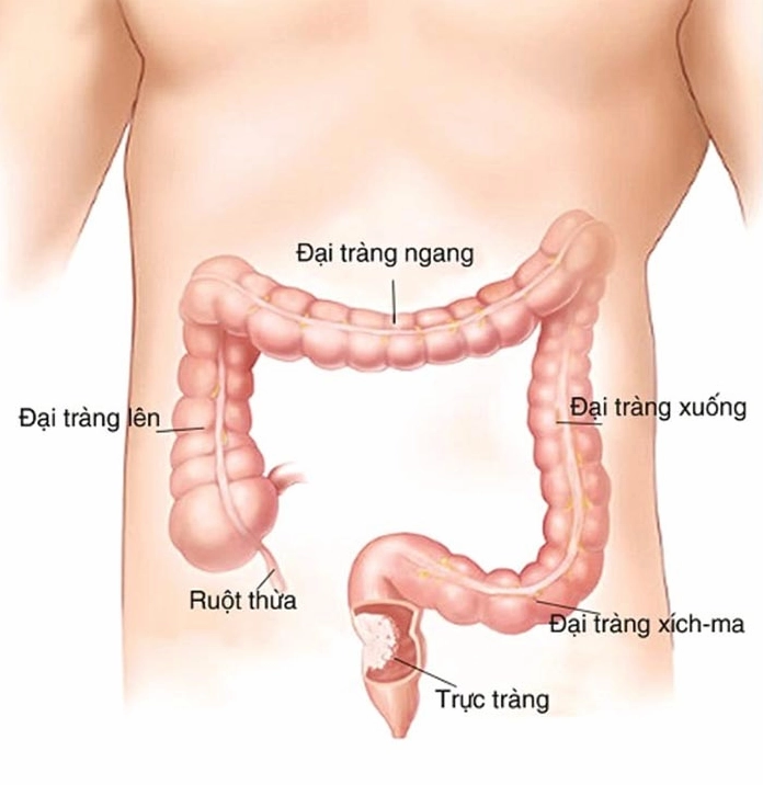 Vị trí đại tràng sigma trong hệ tiêu hóa