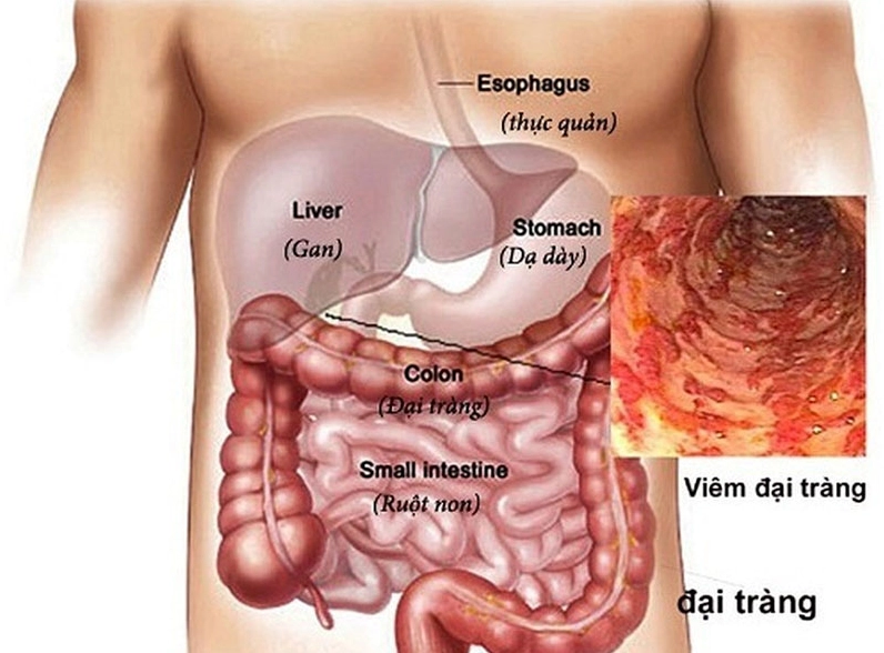 Vị trí của đại tràng trong ổ bụng