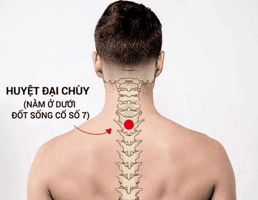 Vị trí huyệt Đại Chùy trên cổ