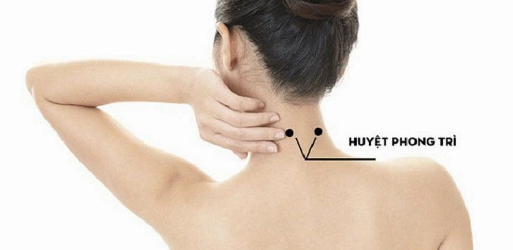Vị trí huyệt Phong Trì trên cổ
