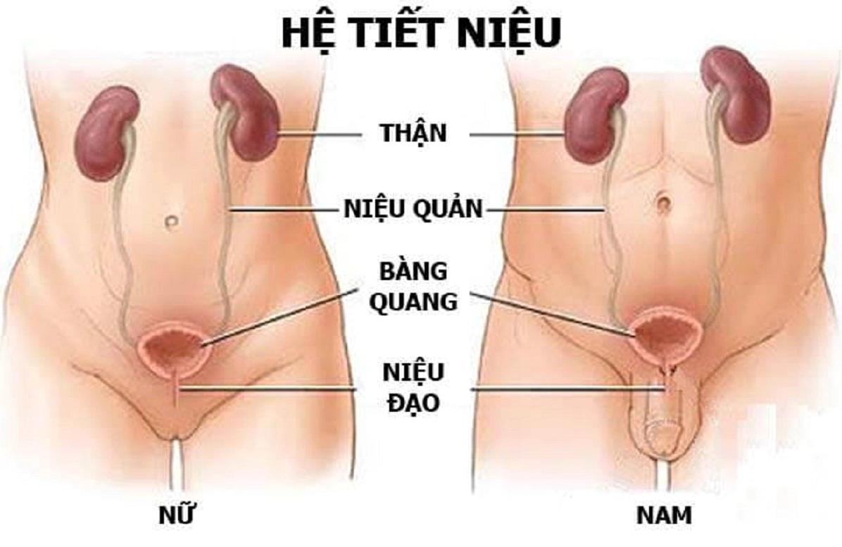 Viêm niệu đạo