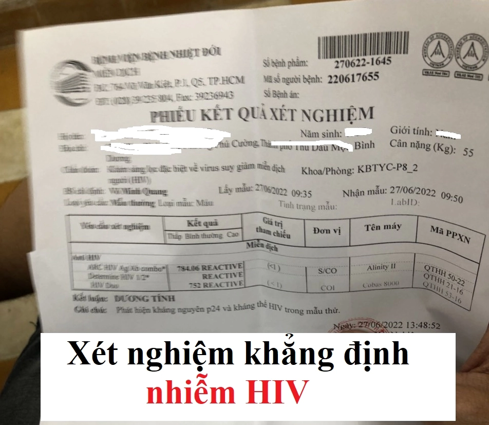 xet-nghiem-hiv-bao-nhieu-tien-chi-phi-cap-nhat-2026_838