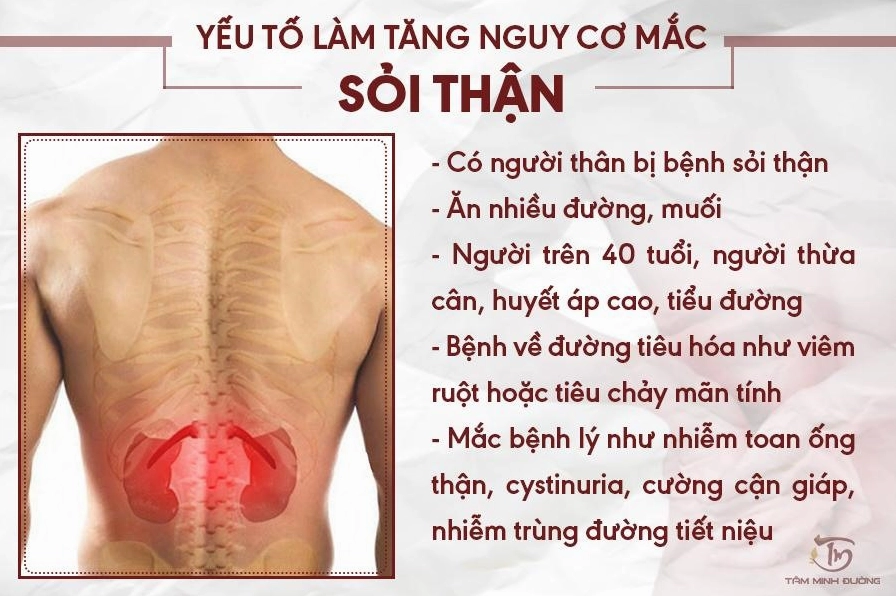 Yếu tố hình thành sỏi thận