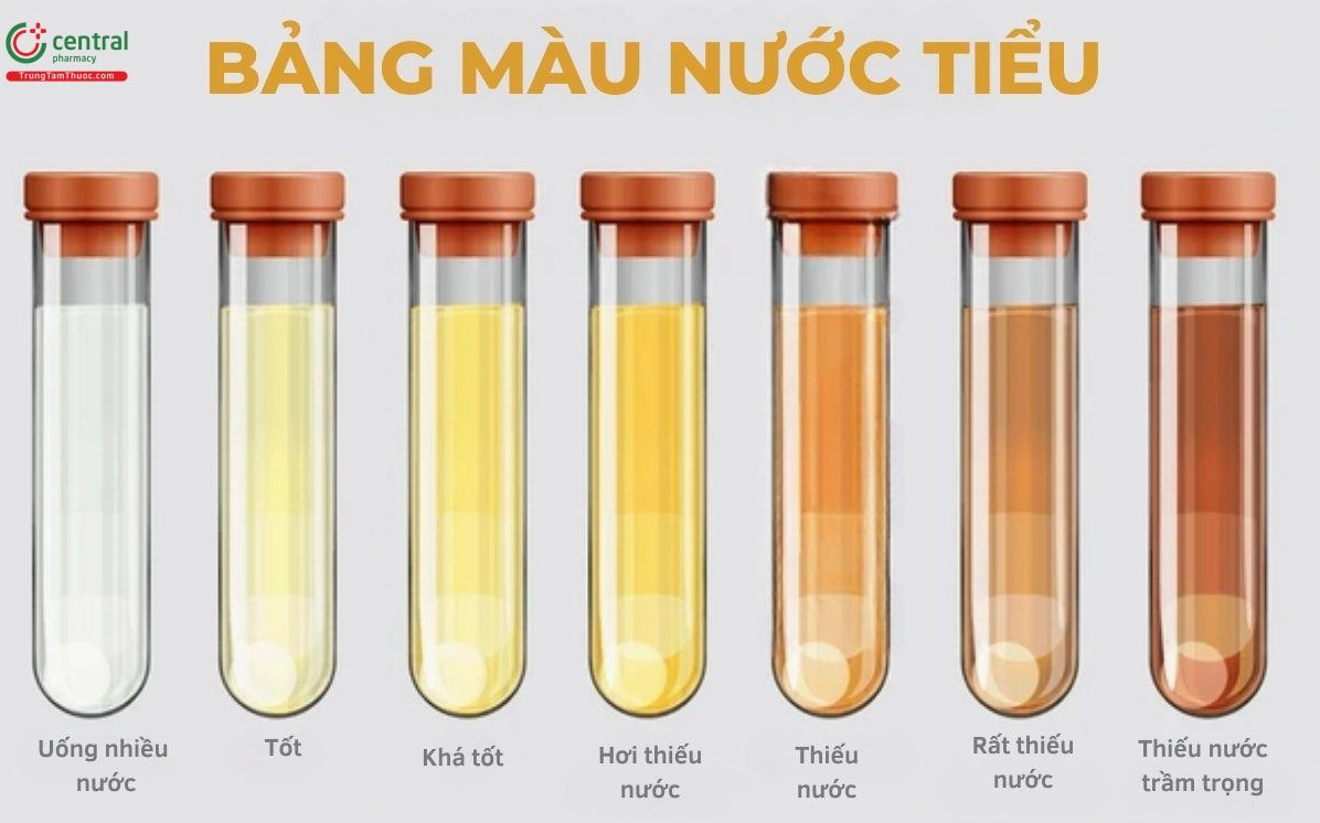 Hình ảnh so sánh màu nước tiểu
